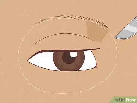 Imagen titulada Fix Asymmetrical Eyes Step 7