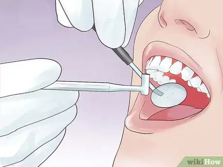 Imagen titulada Protect a Chipped Tooth Step 13