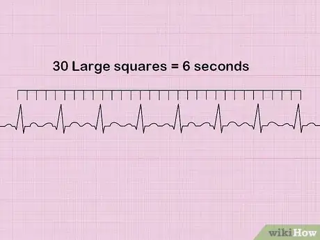 Imagen titulada Calculate Heart Rate from ECG Step 5