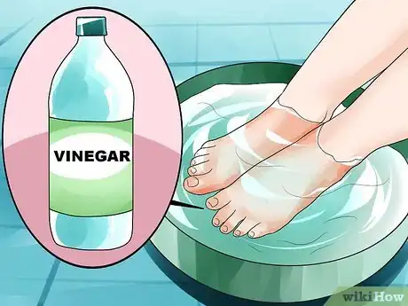 Imagen titulada Get Rid of Foot Fungus Step 6