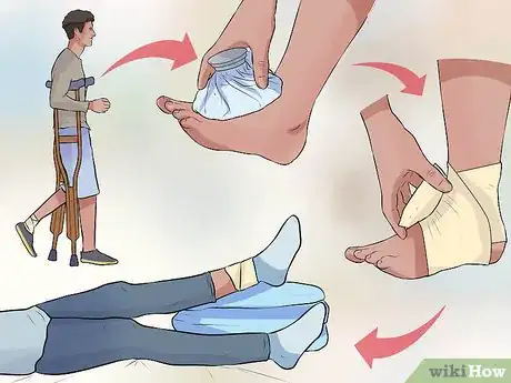 Imagen titulada Treat a Sprain During First Aid Step 1