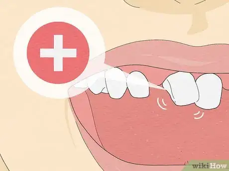 Imagen titulada Pull a Loose Tooth at Home Step 16