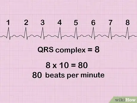 Imagen titulada Calculate Heart Rate from ECG Step 7