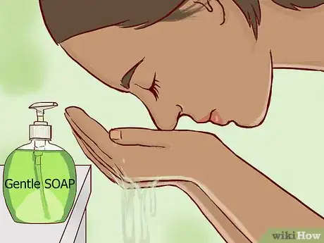 Imagen titulada Treat Eczema Around the Eyes Step 15