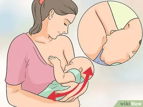 Imagen titulada Heal a Cracked Nipple when Breastfeeding Step 11