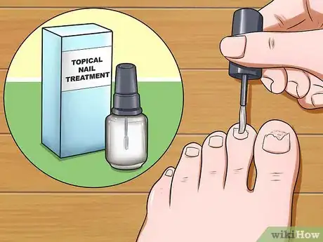 Imagen titulada Prevent Nail Fungus Step 11