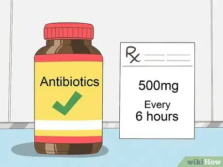 Imagen titulada Treat Cellulitis Step 9