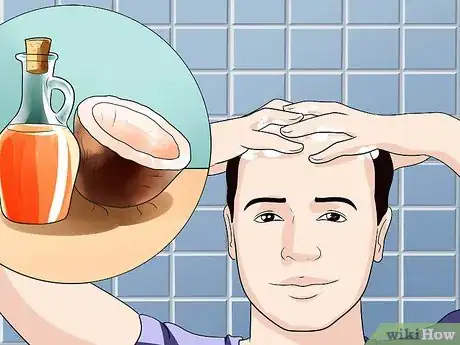 Imagen titulada Treat Male Pattern Hair Loss Step 10