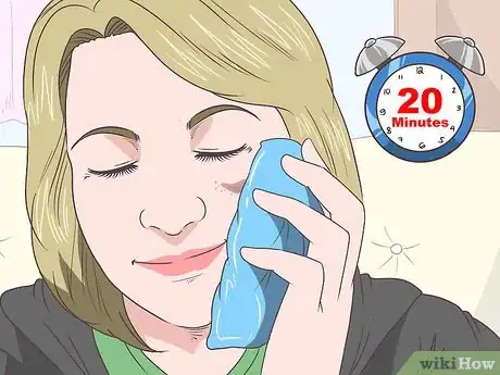 Imagen titulada Treat Bruises on Your Face Step 1