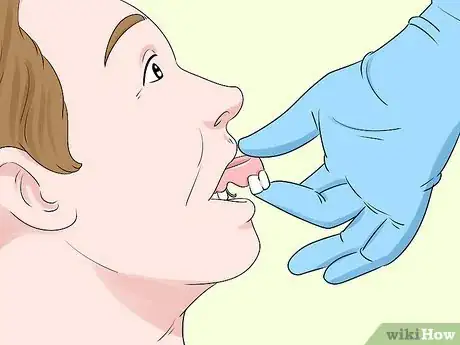 Imagen titulada Cope with Partial Dentures Step 1