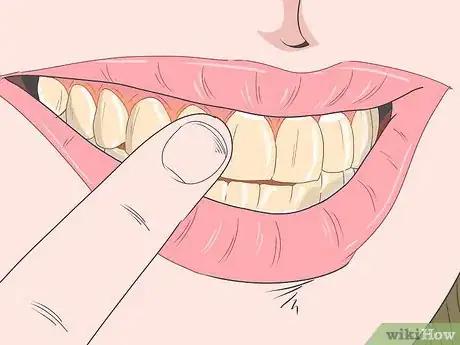 Imagen titulada Use Activated Charcoal for Teeth Whitening Step 13