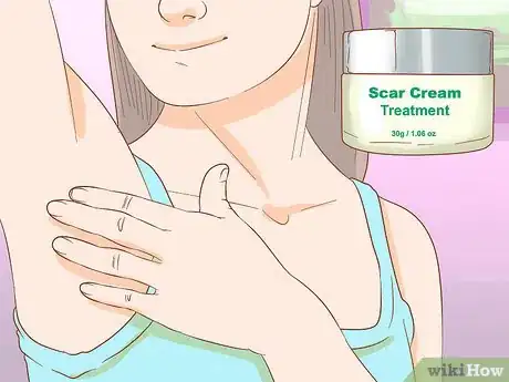 Imagen titulada Get Rid of Boil Scars Step 1