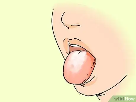 Imagen titulada Get Rid of White Tongue Step 12