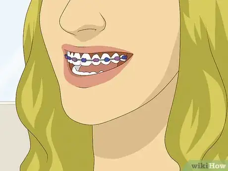 Imagen titulada Look Great With Braces Step 2