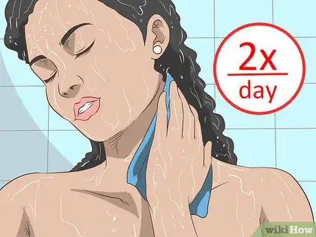 Imagen titulada Get Rid of Neck Acne Step 1