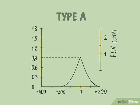 Imagen titulada Read a Tympanogram Step 6