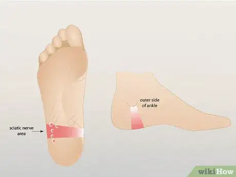 Imagen titulada Relieve Back Pain Through Reflexology Step 2