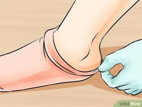 Imagen titulada Put on Compression Stockings Step 9
