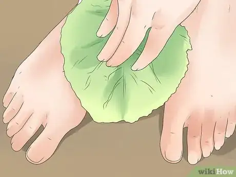 Imagen titulada Get Rid of Gout when Pregnant Step 5