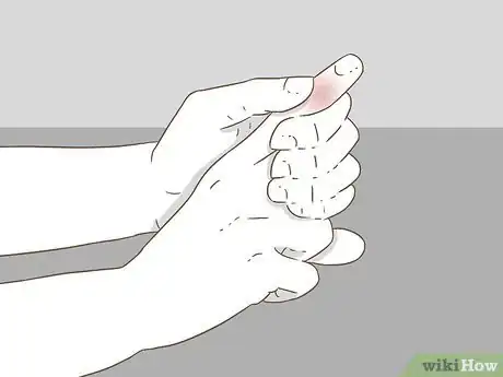 Imagen titulada Determine if a Finger Is Broken Step 14