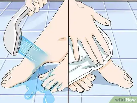 Imagen titulada Remove Stains from Your Feet Step 13