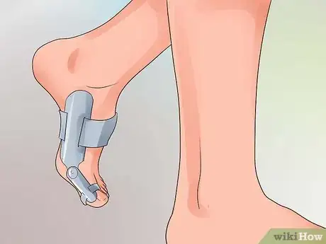 Imagen titulada Heal a Broken Toe Step 9