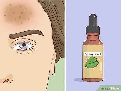 Imagen titulada Get Rid of Brown Spots Using Home Remedies Step 3