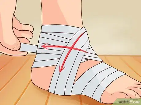 Imagen titulada Wrap an Ankle Step 10