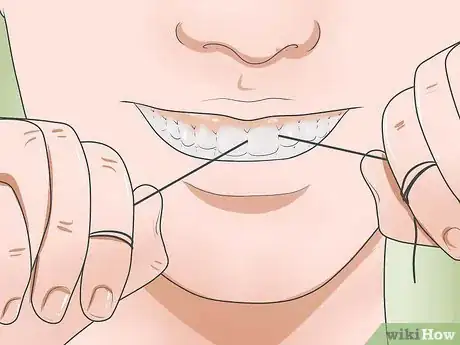 Imagen titulada Reduce Gum Swelling Step 3