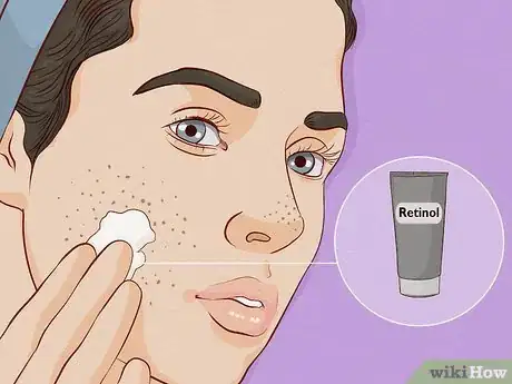 Imagen titulada Close Blackhead Holes Step 7