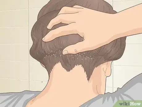 Imagen titulada Bumps on Scalp Step 5