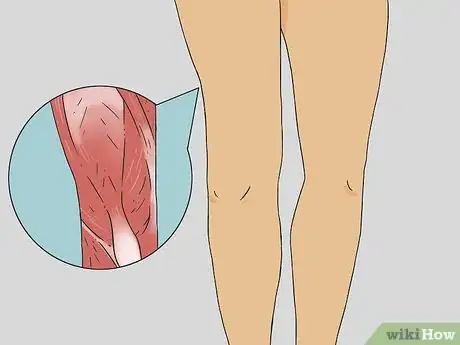 Imagen titulada Give a Leg Massage Step 1