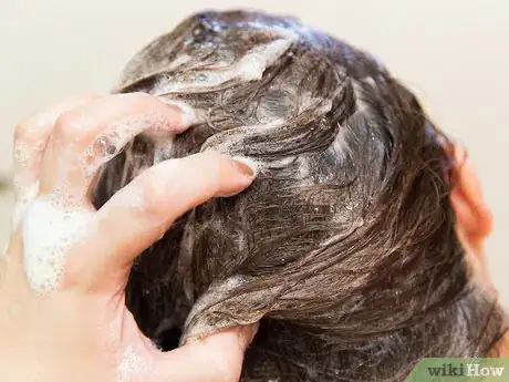 Imagen titulada Prevent and Treat Dandruff Step 8