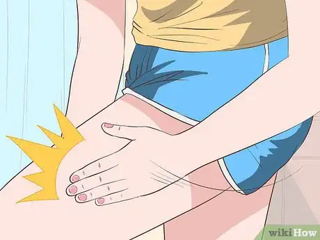 Imagen titulada Stop Mosquito Bites from Itching Step 17