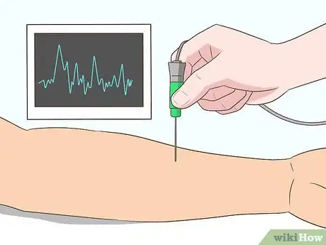 Imagen titulada Diagnose ALS (Amyotrophic Lateral Sclerosis) Step 9