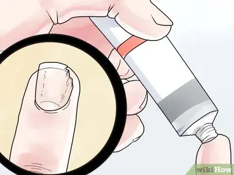 Imagen titulada Stop Your Cuticle Skin from Peeling Step 10