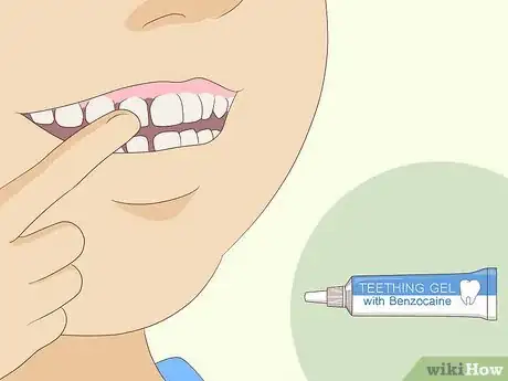 Imagen titulada Pull Out a Tooth Without Pain Step 5