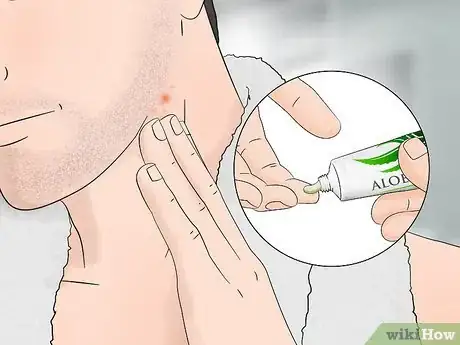 Imagen titulada Stop Itching After Shaving Step 3