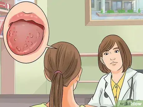 Imagen titulada Get Rid of Bumps on Your Tongue Step 13