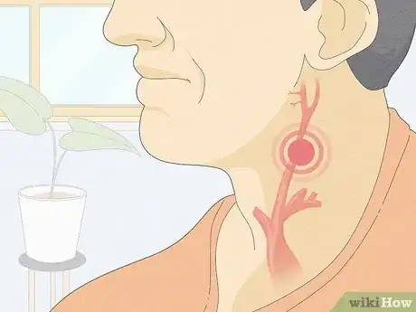 Imagen titulada Perform a Carotid Massage Step 11