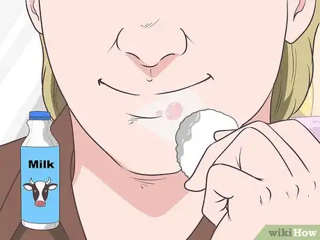 Imagen titulada Treat a Cold Sore or Fever Blisters Step 16