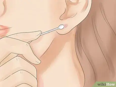 Imagen titulada Take Care of Infection in Newly Pierced Ears Step 5