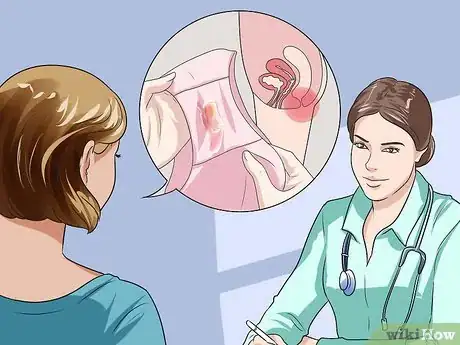 Imagen titulada Recognize Chlamydia Symptoms (for Women) Step 4