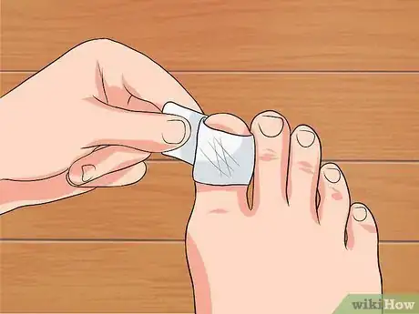 Imagen titulada Remove a Dead Toenail Step 10