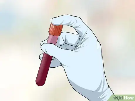 Imagen titulada Get Tested for STDs Without Letting Your Parents Know Step 4