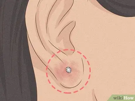 Imagen titulada Clean a New Ear Piercing Step 20