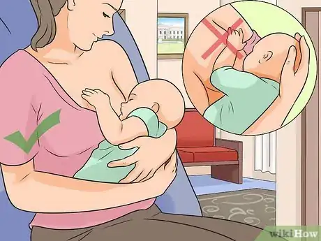 Imagen titulada Heal a Cracked Nipple when Breastfeeding Step 10