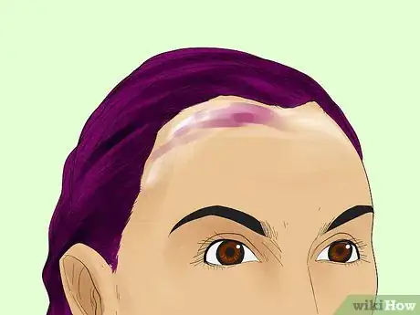 Imagen titulada Remove Hair Dye from Your Scalp Step 12