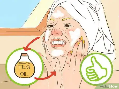 Imagen titulada Be Confident If You Have Acne Step 13
