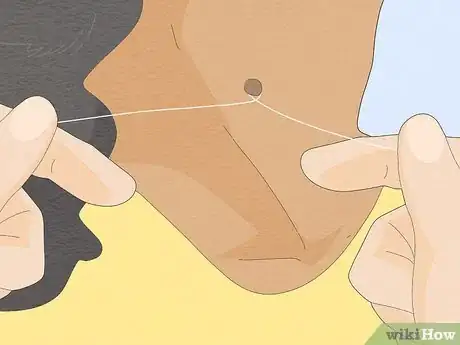 Imagen titulada Remove a Skin Tag from Your Neck Step 3